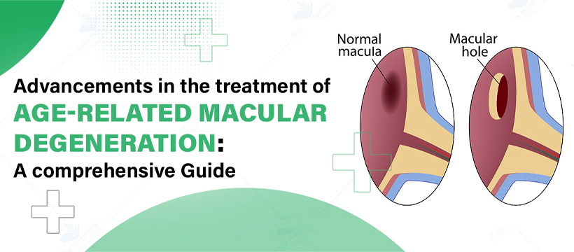 Age-Related Macular Degeneration: Prevention and Treatment