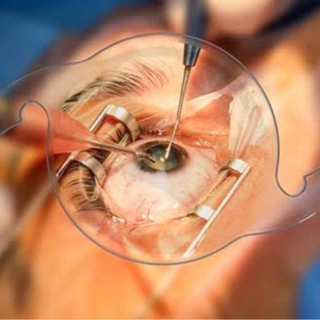 Women's Eye Health