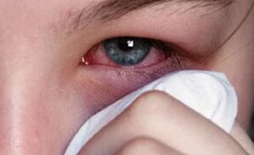 Ocular Inflammatiom and Uveitis Treatment
