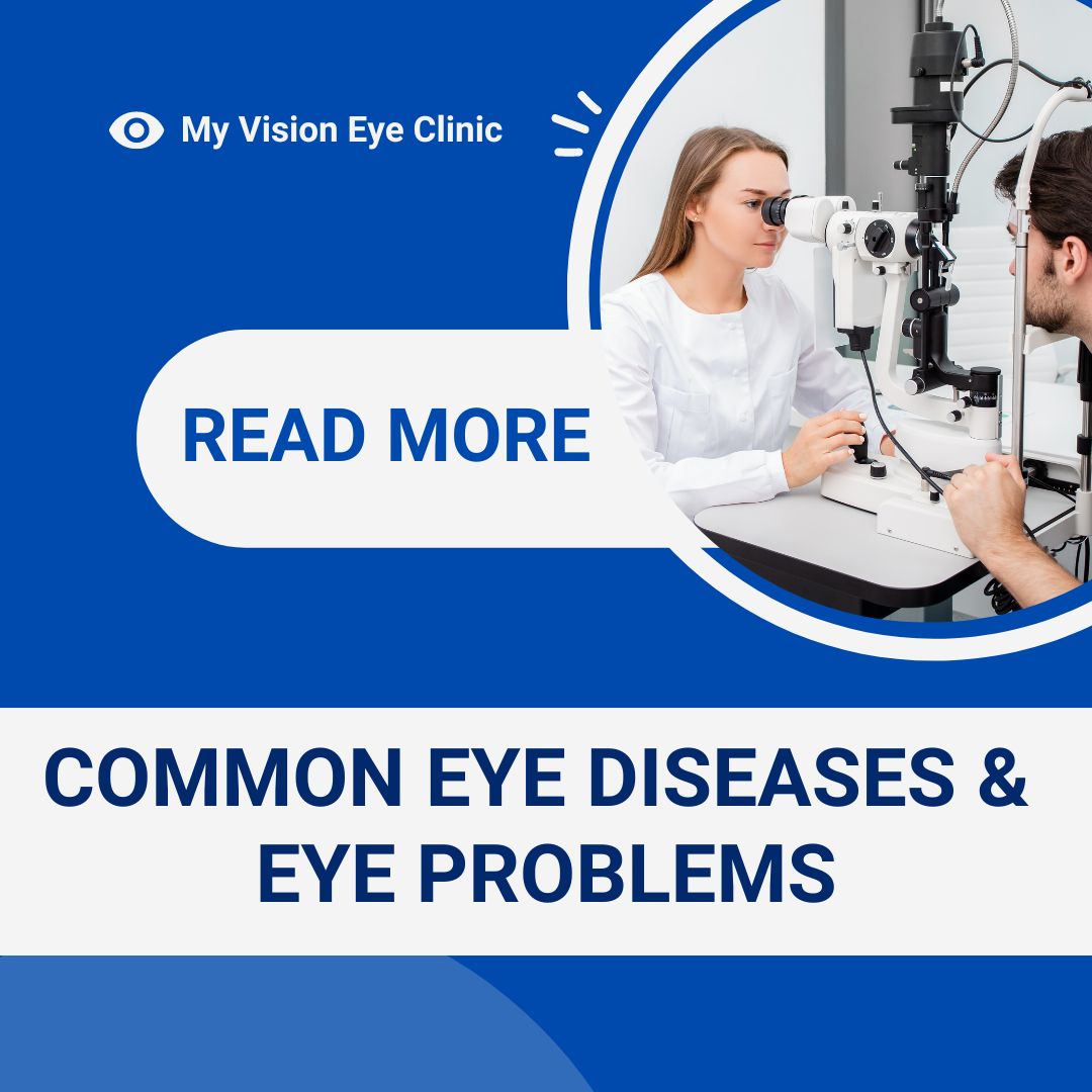 Common Eye Diseases and Eye Problems