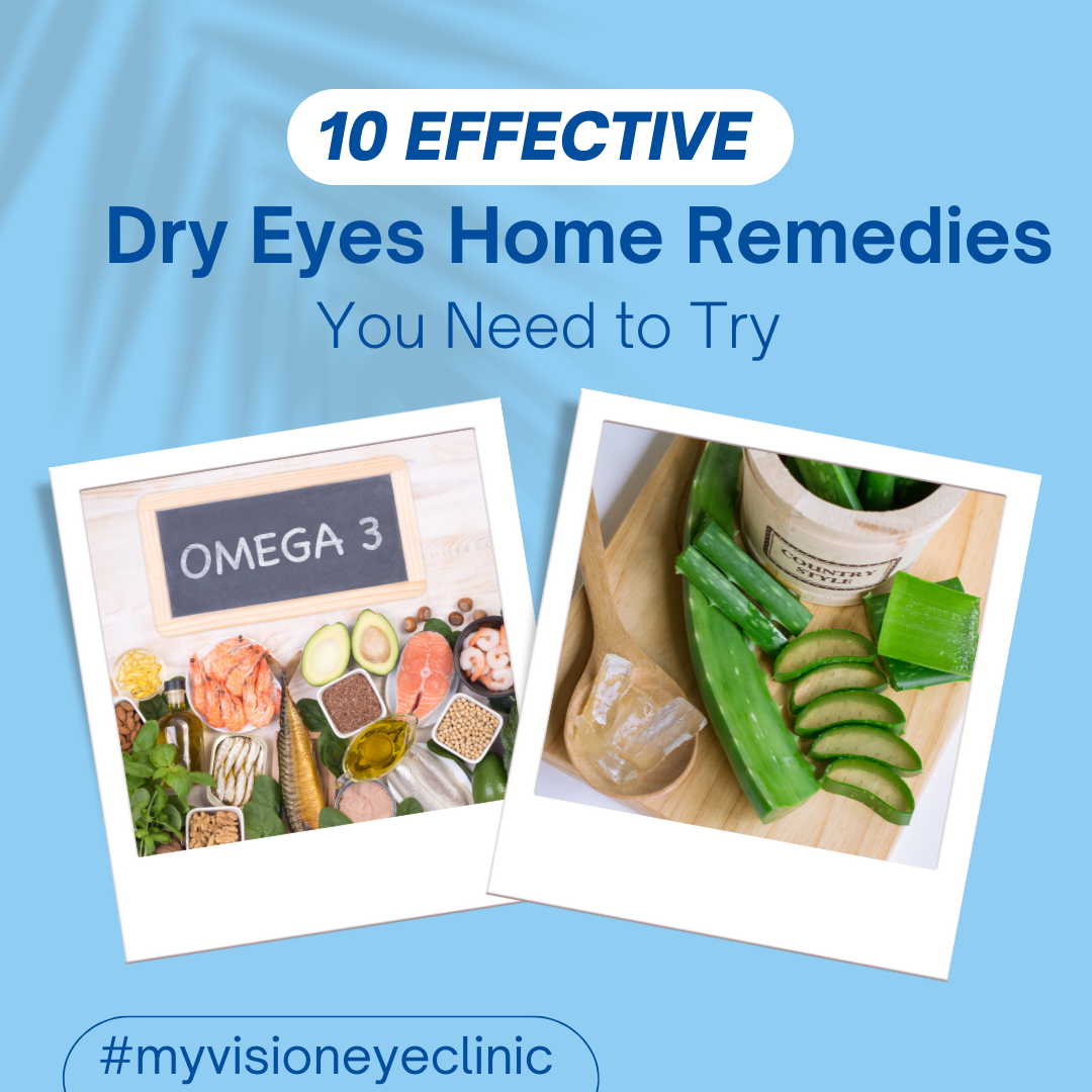 dry eye home remedies